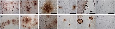 Nitrosative Stress in the Frontal Cortex From Dogs With Canine Cognitive Dysfunction